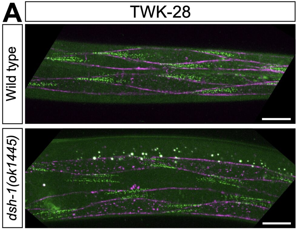 Functional validation of human SK channels variants causing NEDMAB and Zimmermann–Laband syndrome-3 in C. elegans